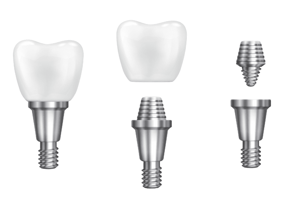 implant çeşitleri-bizdentalklinik